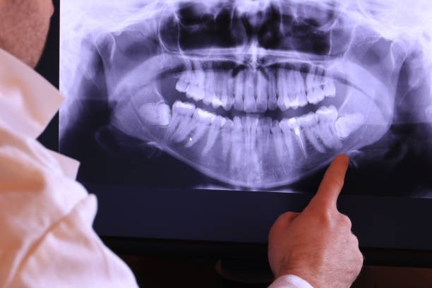 Best Emergency Denture Repair in White Marsh, MD